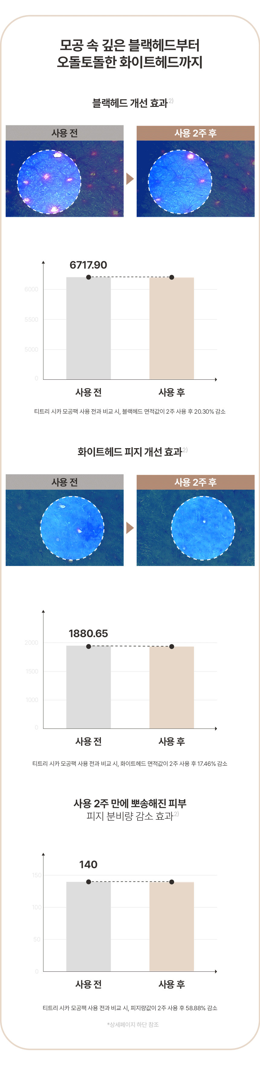 피지개선.gif