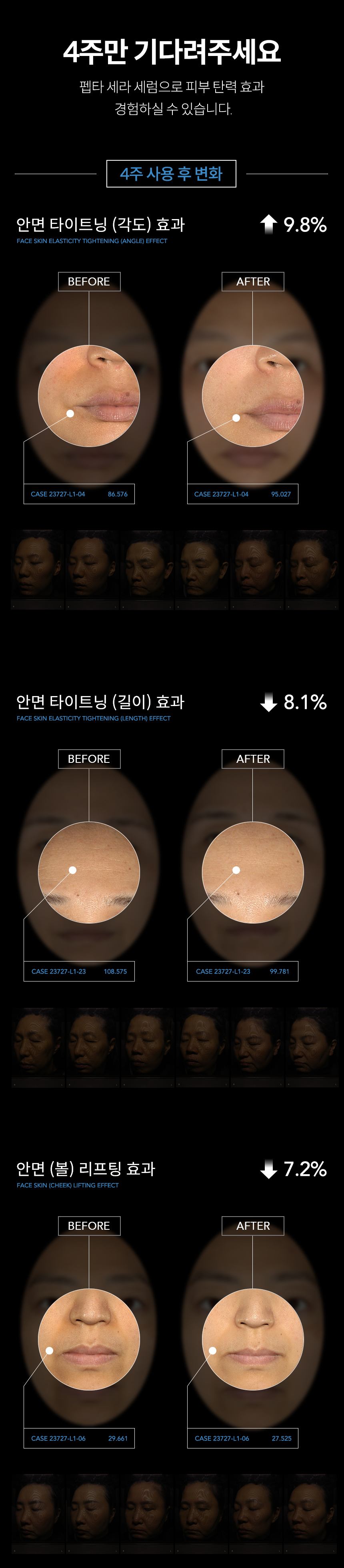 펩타_세라_리프팅_세럼_05.jpg