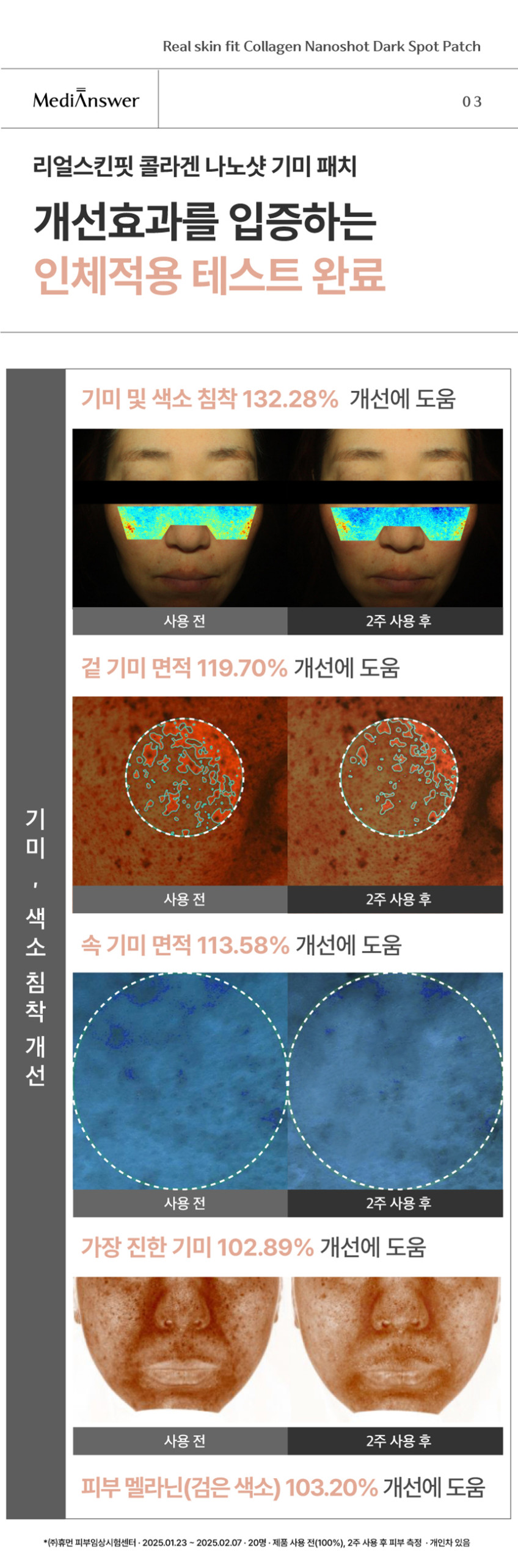 나노샷_기미패치_(4).jpg