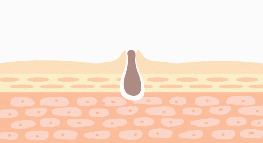 patch_green2.gif